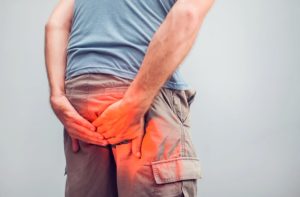 Czy większość problemów z odbytem to hemoroidy?